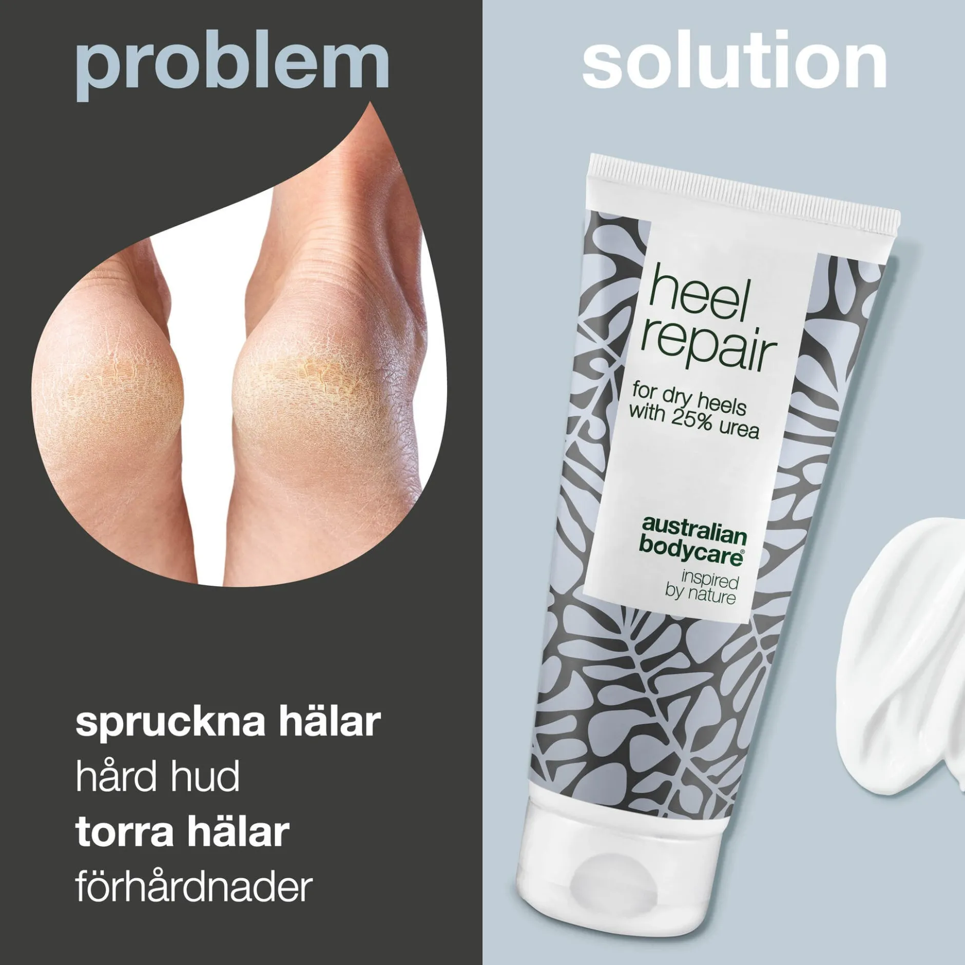 Australian Bodycare Hälkräm 25% Urea för hälsprickor 100 ml