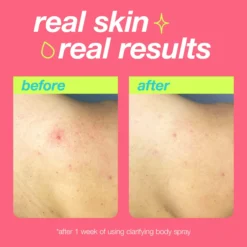 Clear Start by Dermalogica Clarifying Body Spray 177 ml