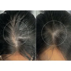Foreo LUNA™ Dual-Peptide Scalp Serum 60ml