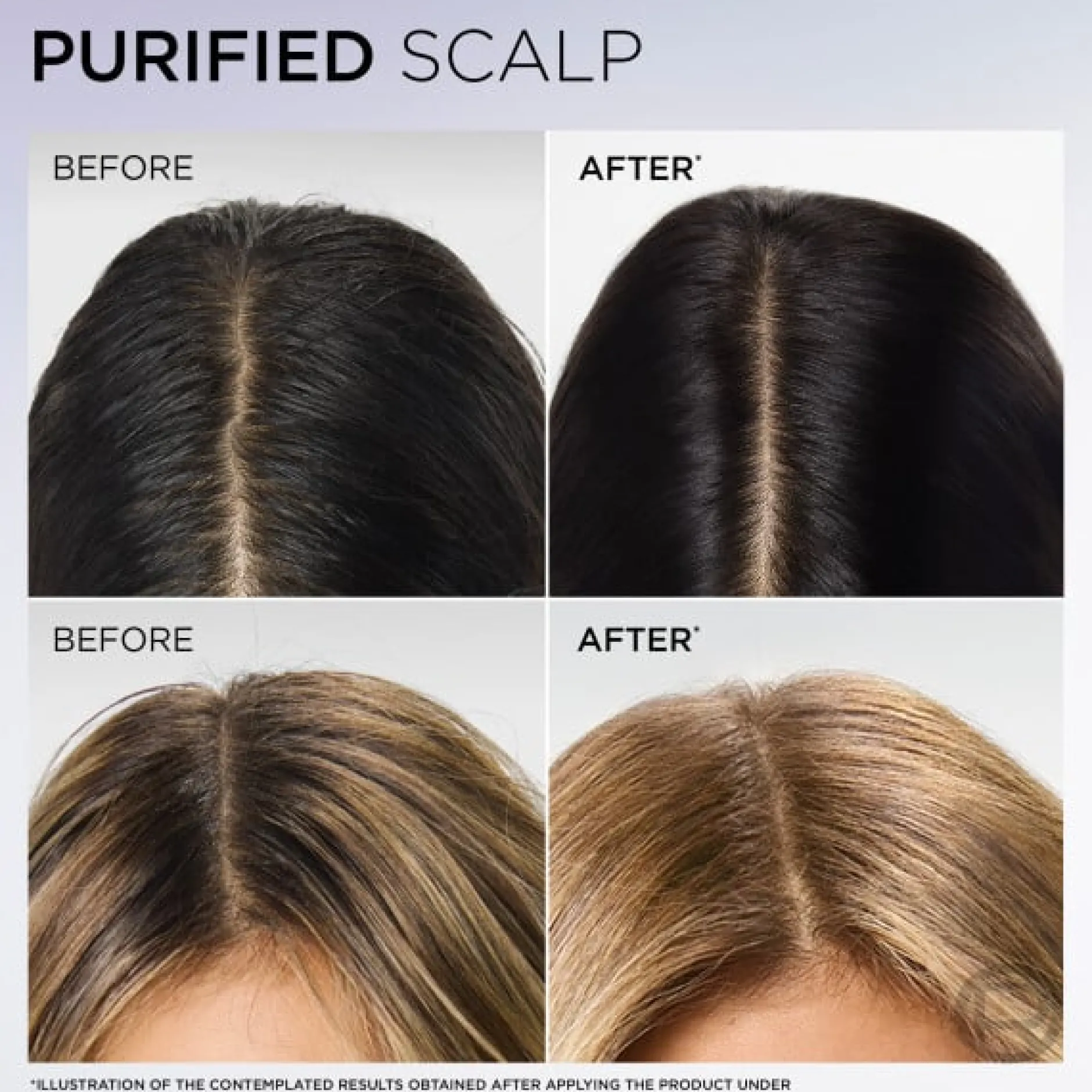 L'Oréal Paris Elvital Hyaluron Pure Schampo För Fuktfattigt Hår 500 ml
