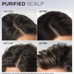 L'Oréal Paris Elvital Hyaluron Pure Schampo För Fuktfattigt Hår 500 ml