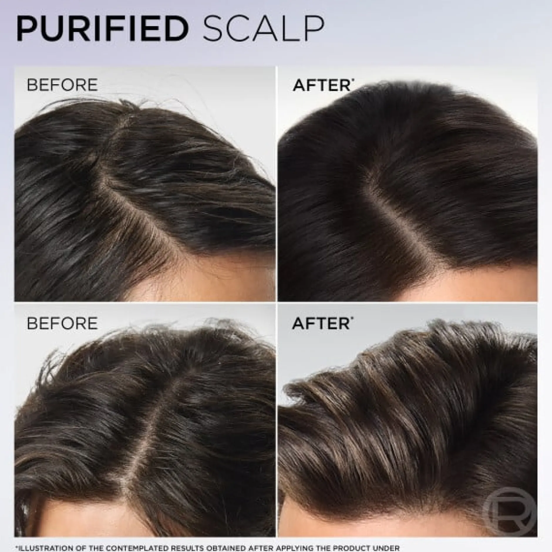 L'Oréal Paris Elvital Hyaluron Pure Schampo För Fuktfattigt Hår 500 ml