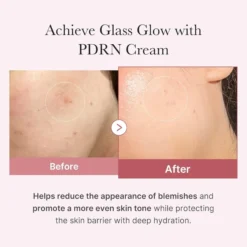 Medicube PDRN Pink Hyaluronic Moisturizing Cream 50 ml