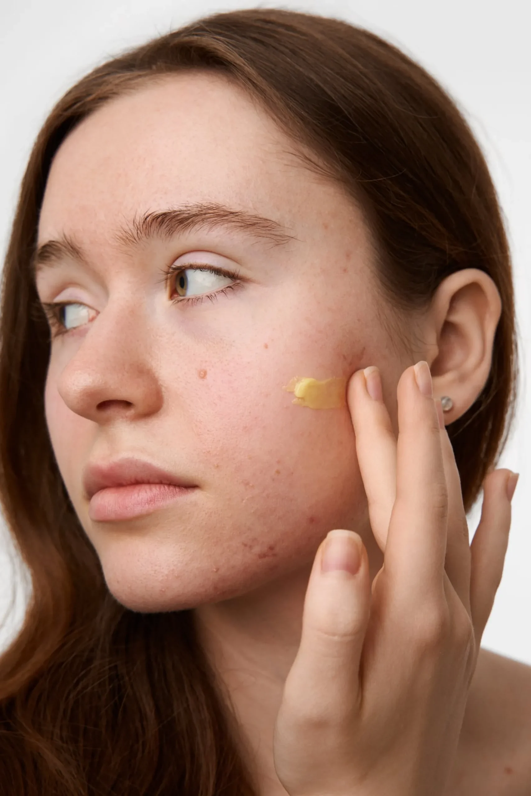 Skinome Azeretinal Concentrate 30 ml