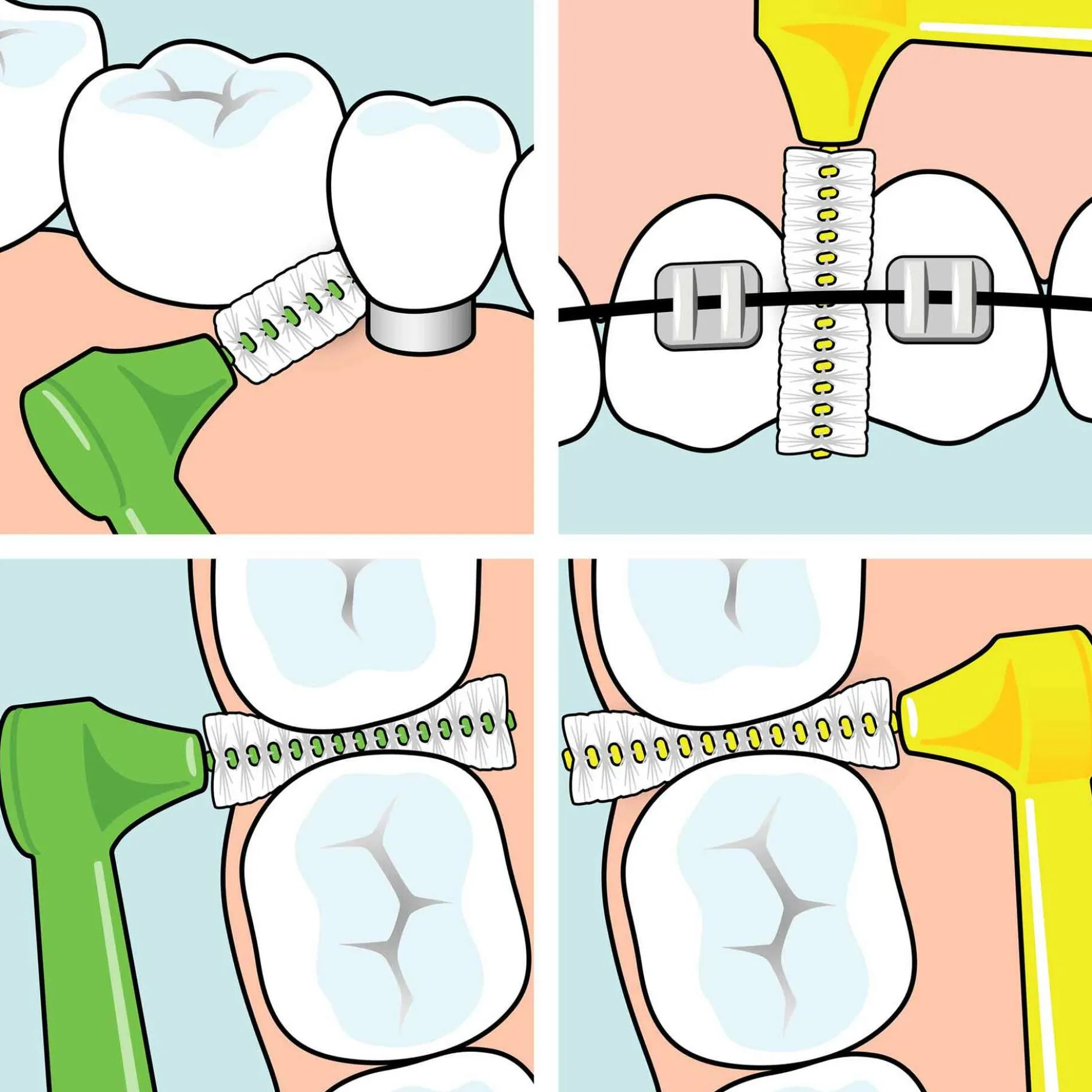 TePe Angle Vinklad Mellanrumsborste 0,7mm Gul 6-pack