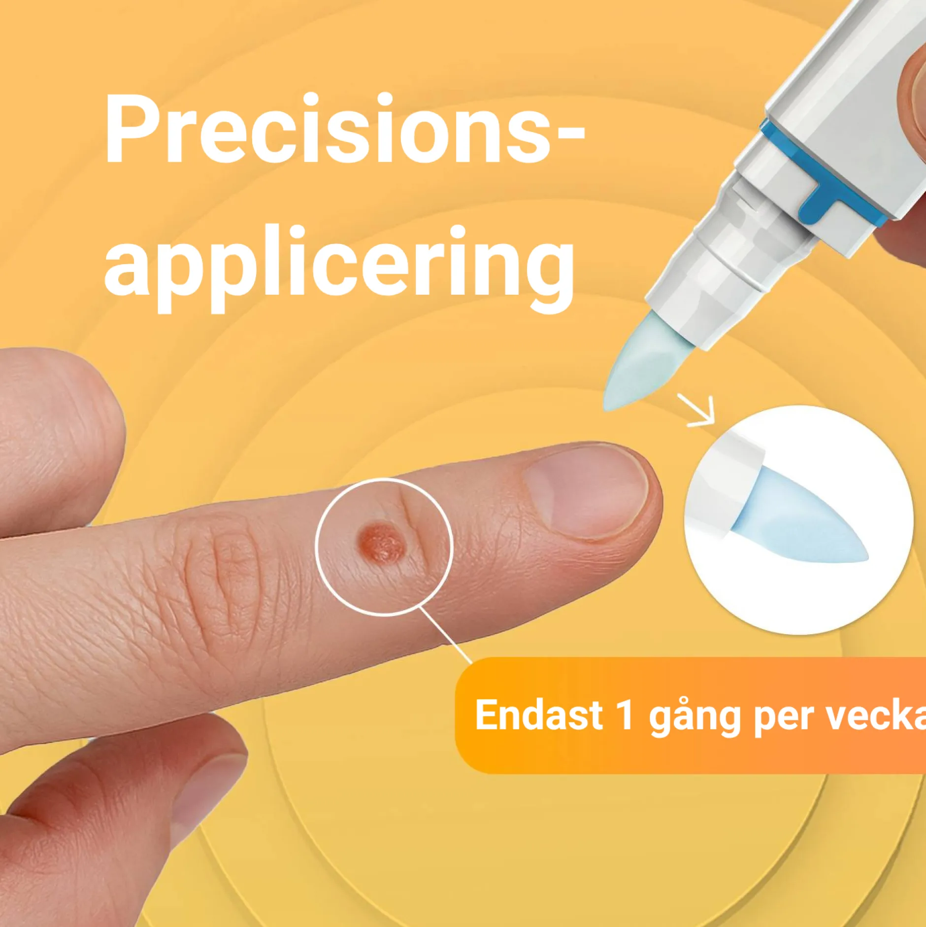 VårtFri Pen 30 behandlingar