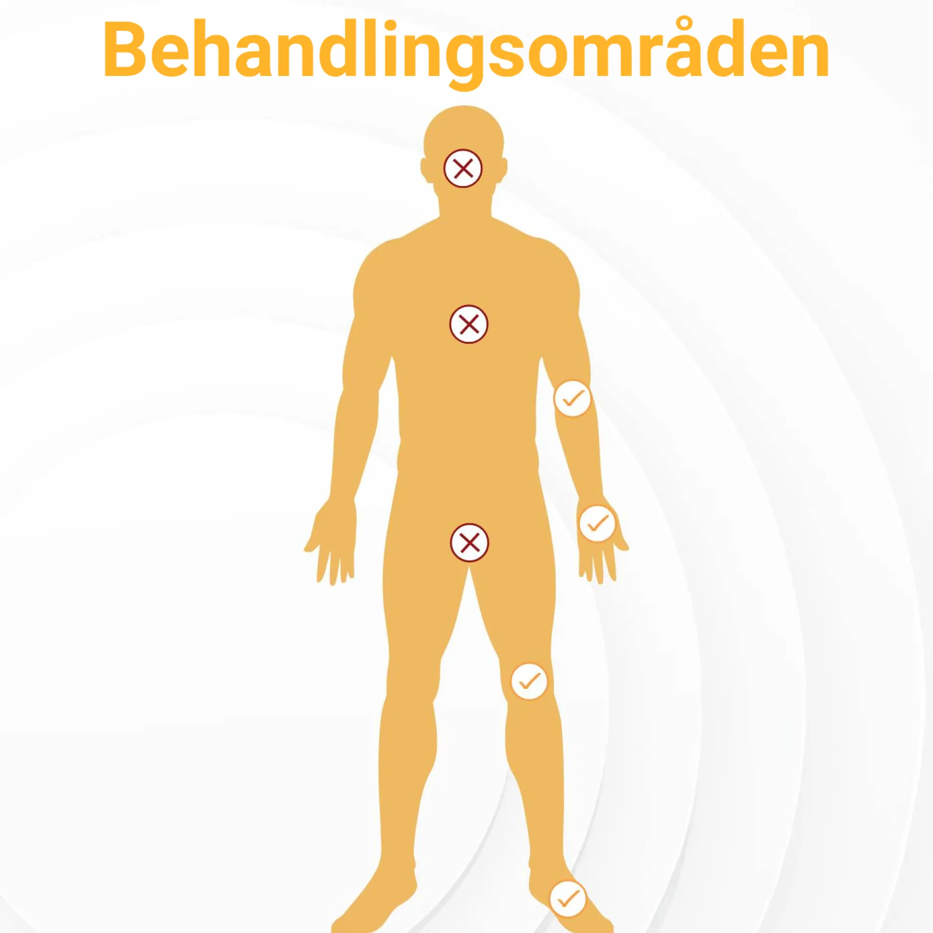 VårtFri Pen 30 behandlingar