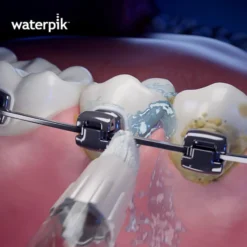Waterpik OD-100E Orthodontic Tip 2 st