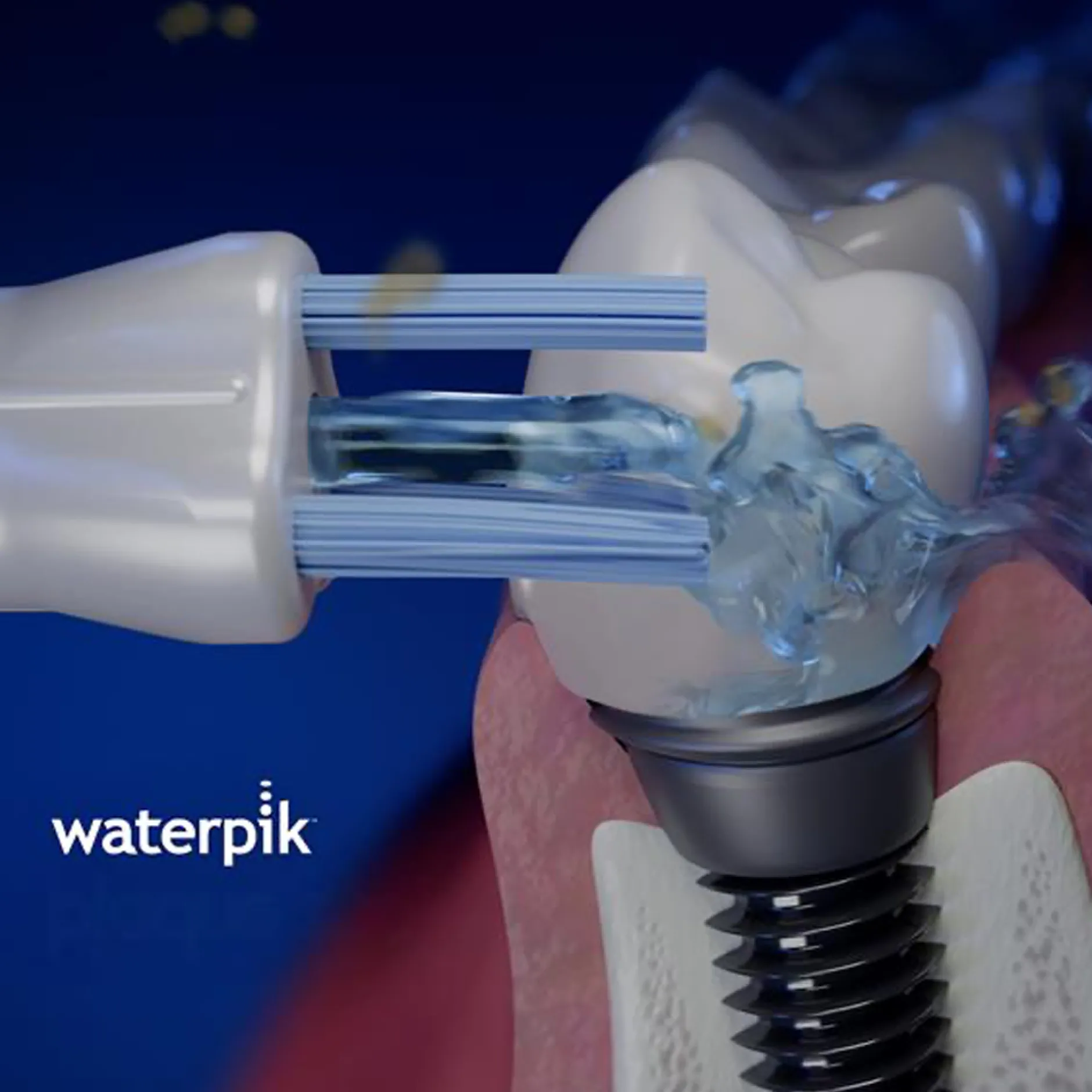 Waterpik PS-100E Plaque Seeker Tip 2 st